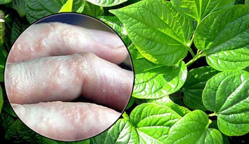 Lá lốt trị được bệnh gì?